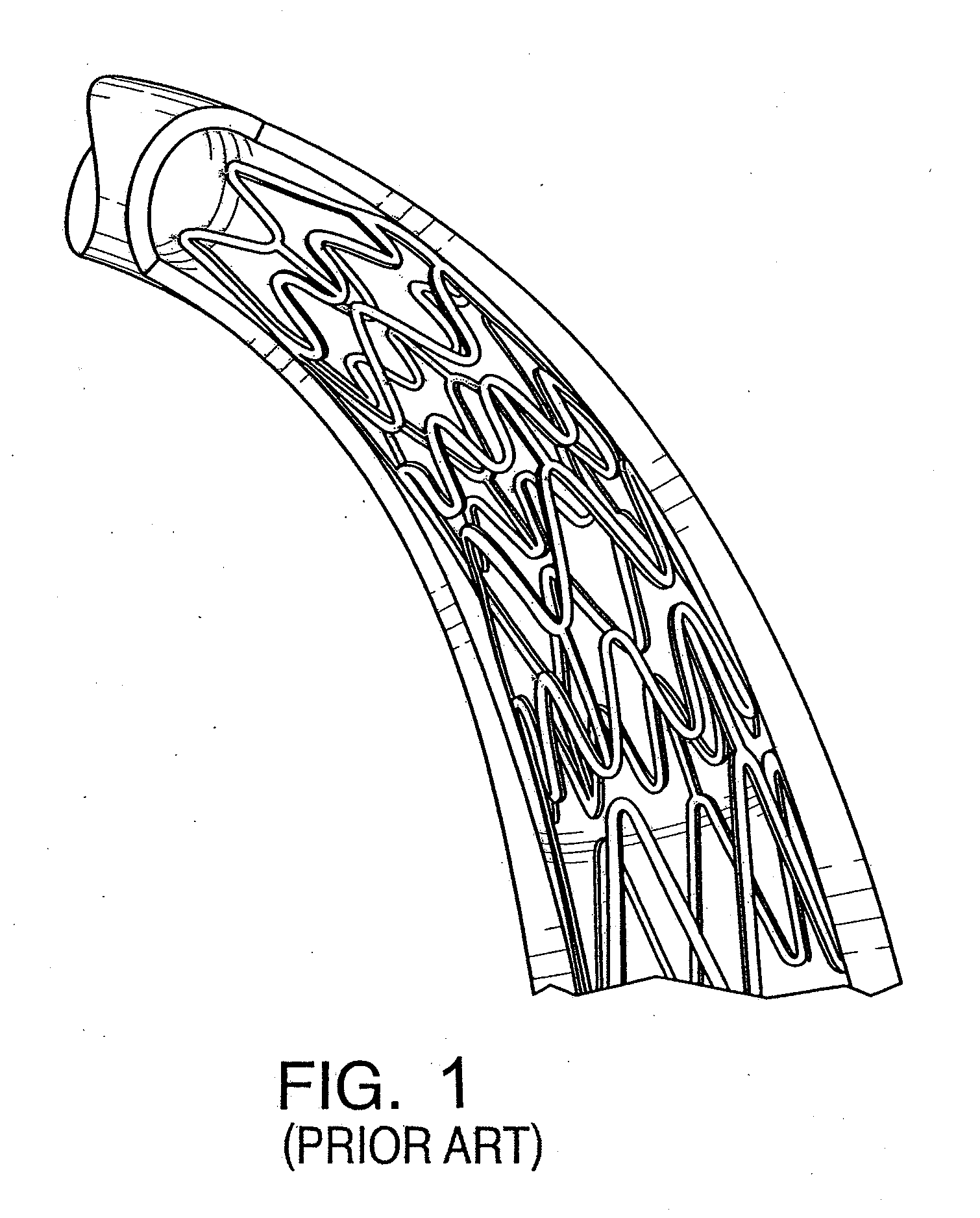 Stent device having focal elevating elements for minimal surface area contact with lumen walls
