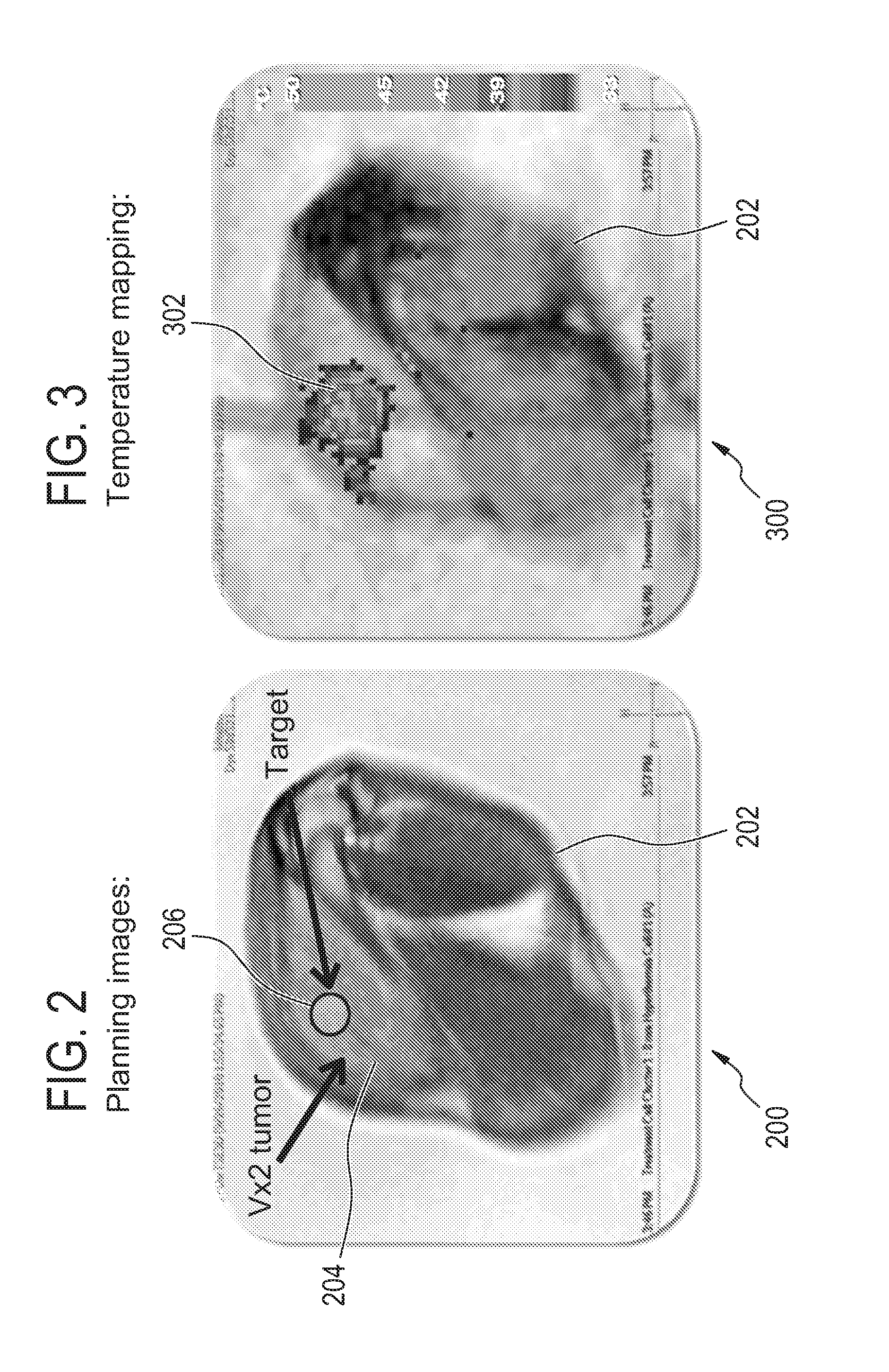 Therapeutic apparatus for heating a subject