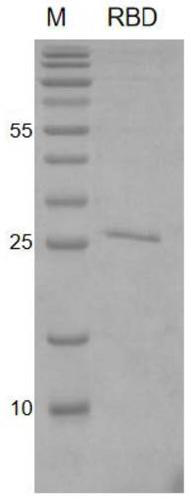 Renaturation method of COVID-19 recombinant protein inclusion bodies