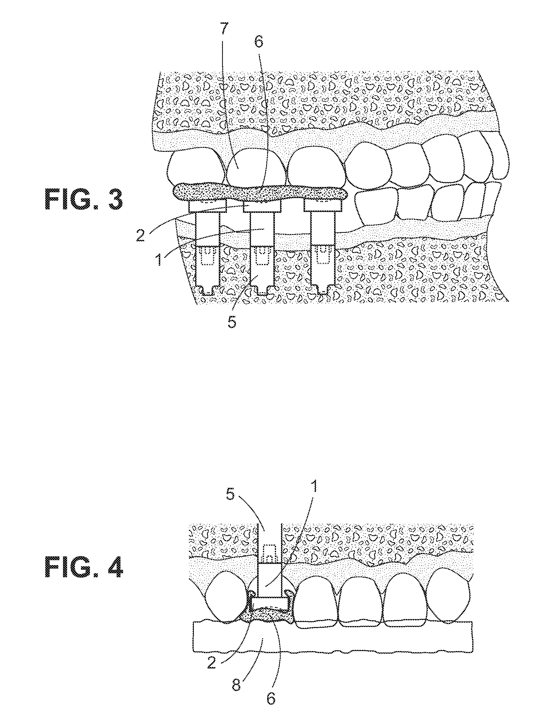 Device and Method for Capturing Dental Records
