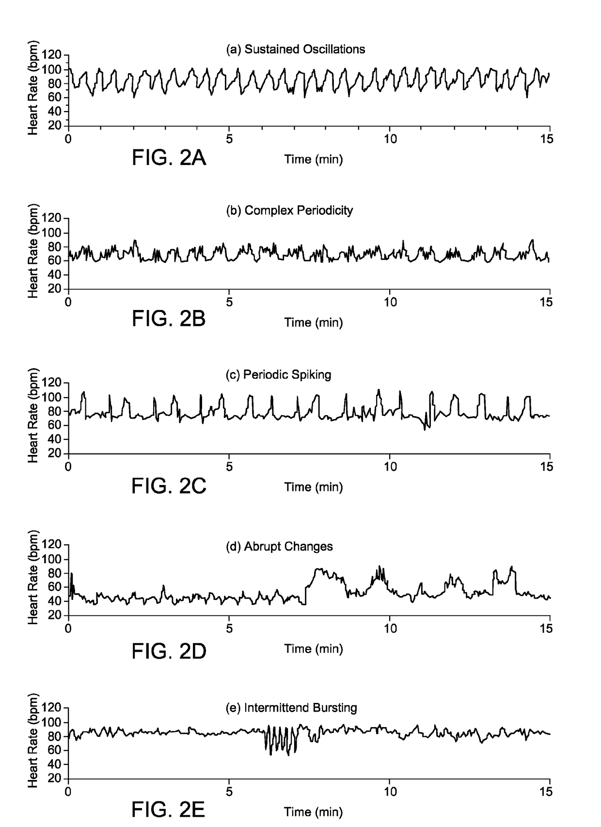 Ventricular activation (RR) entropy change as a predictor of sudden cardiac death in cardiac resynchronization therapy patients