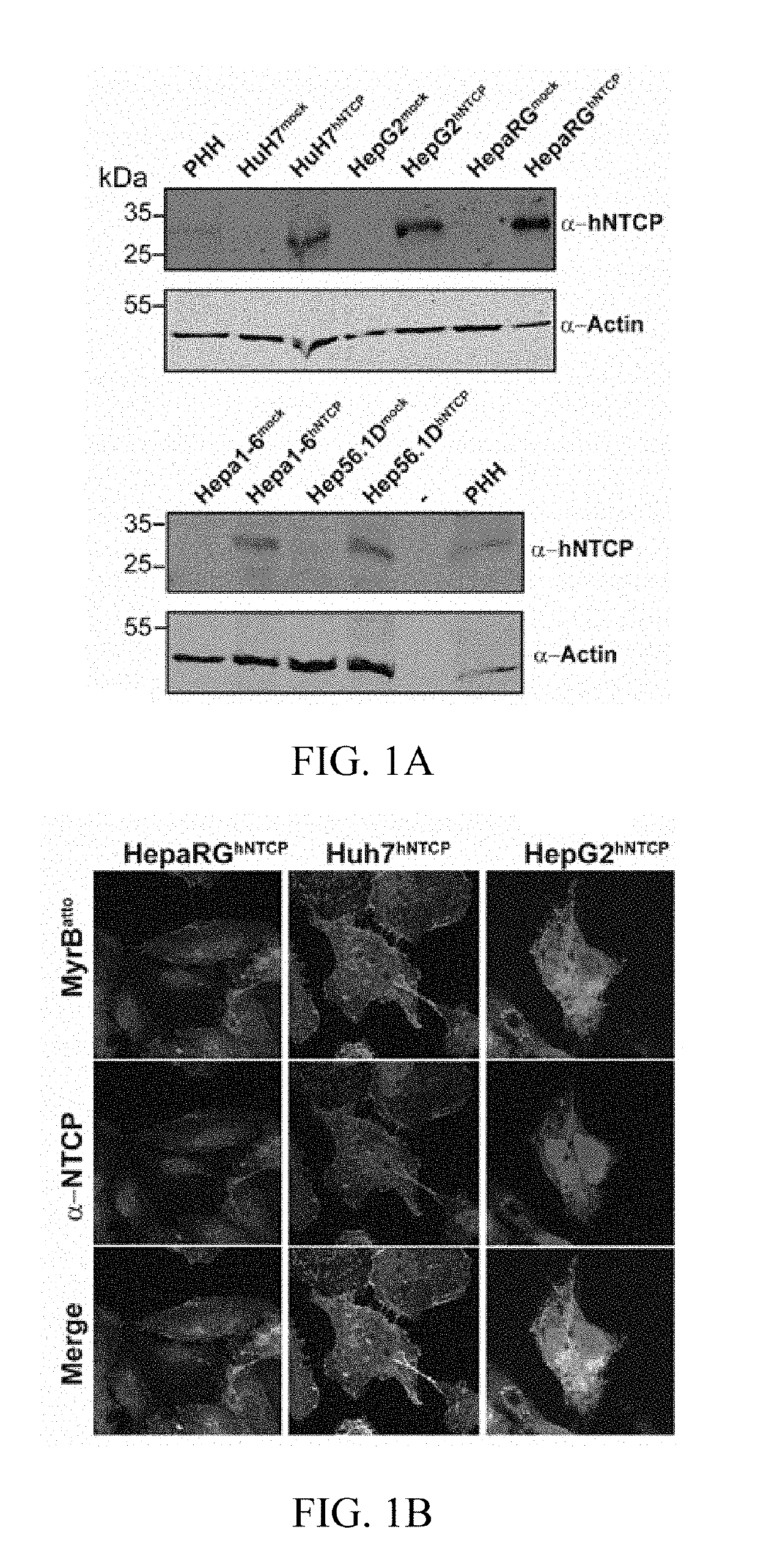 Lipopeptides for Use in Treating Liver Diseases and Cardiovascular Diseases