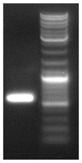 PD-L1 nanobody as well as preparation method and application thereof