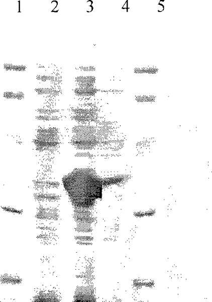 Method for preparing A gene of recombined protein, and expressed products and application