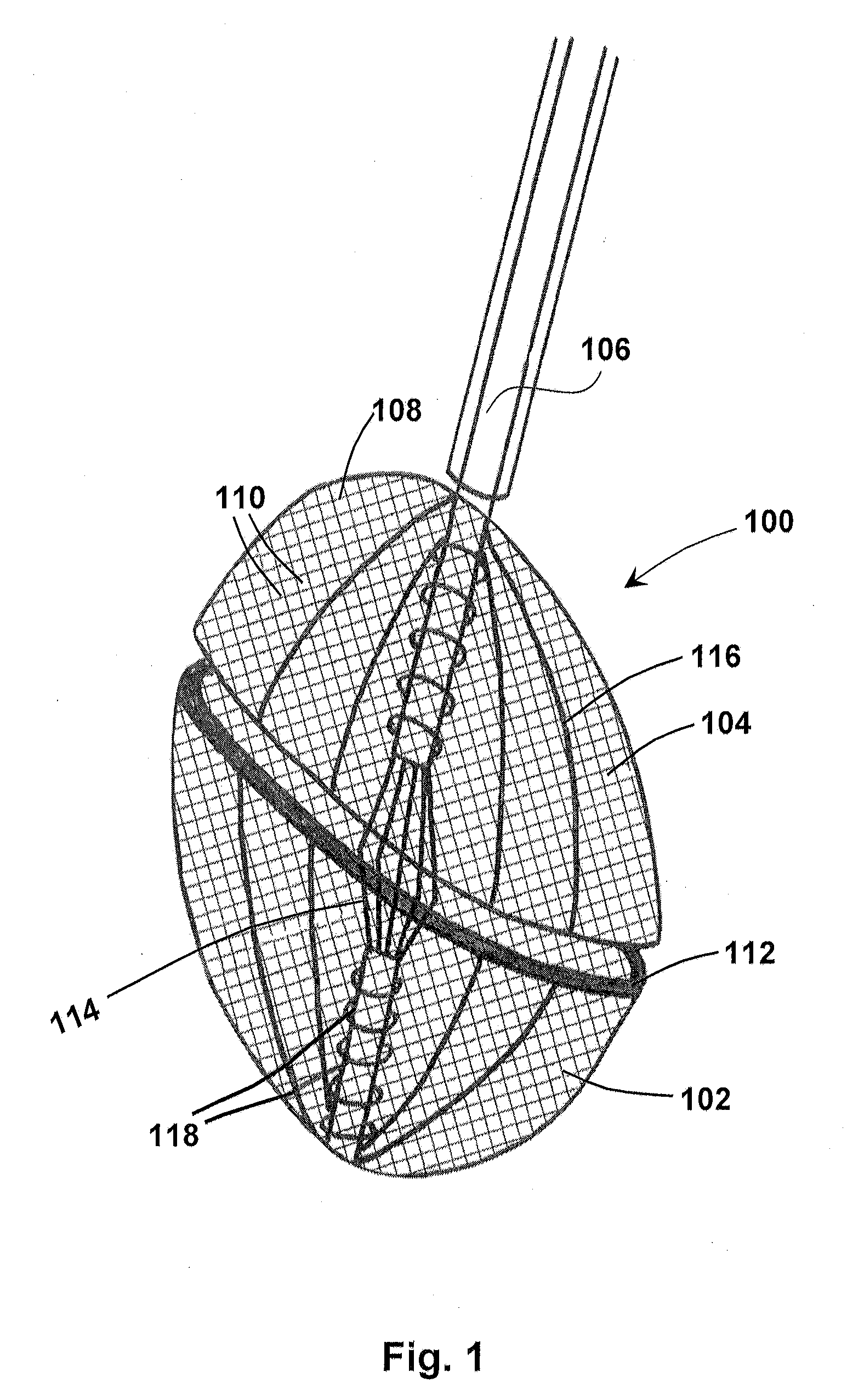 Methods for removing a valve from a vessel