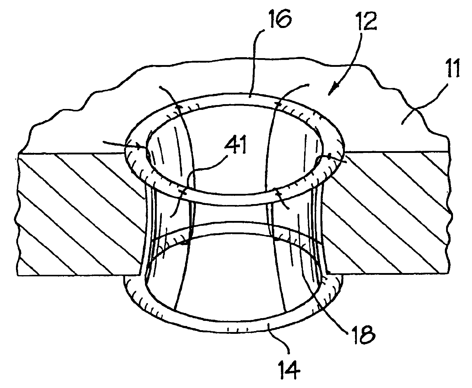 Wound retraction apparatus and method
