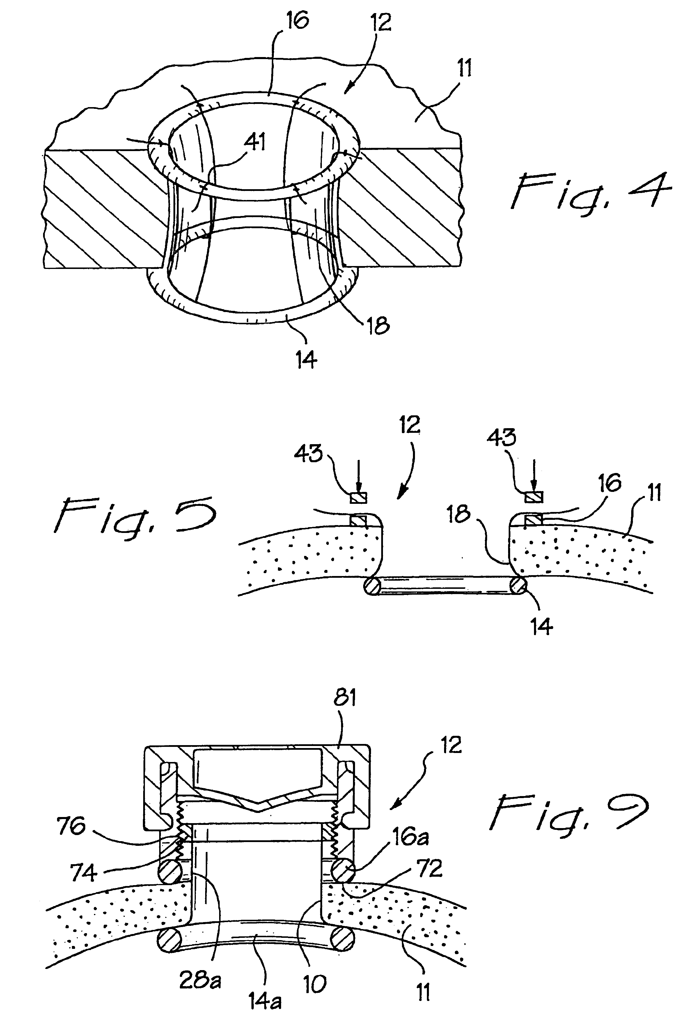 Wound retraction apparatus and method