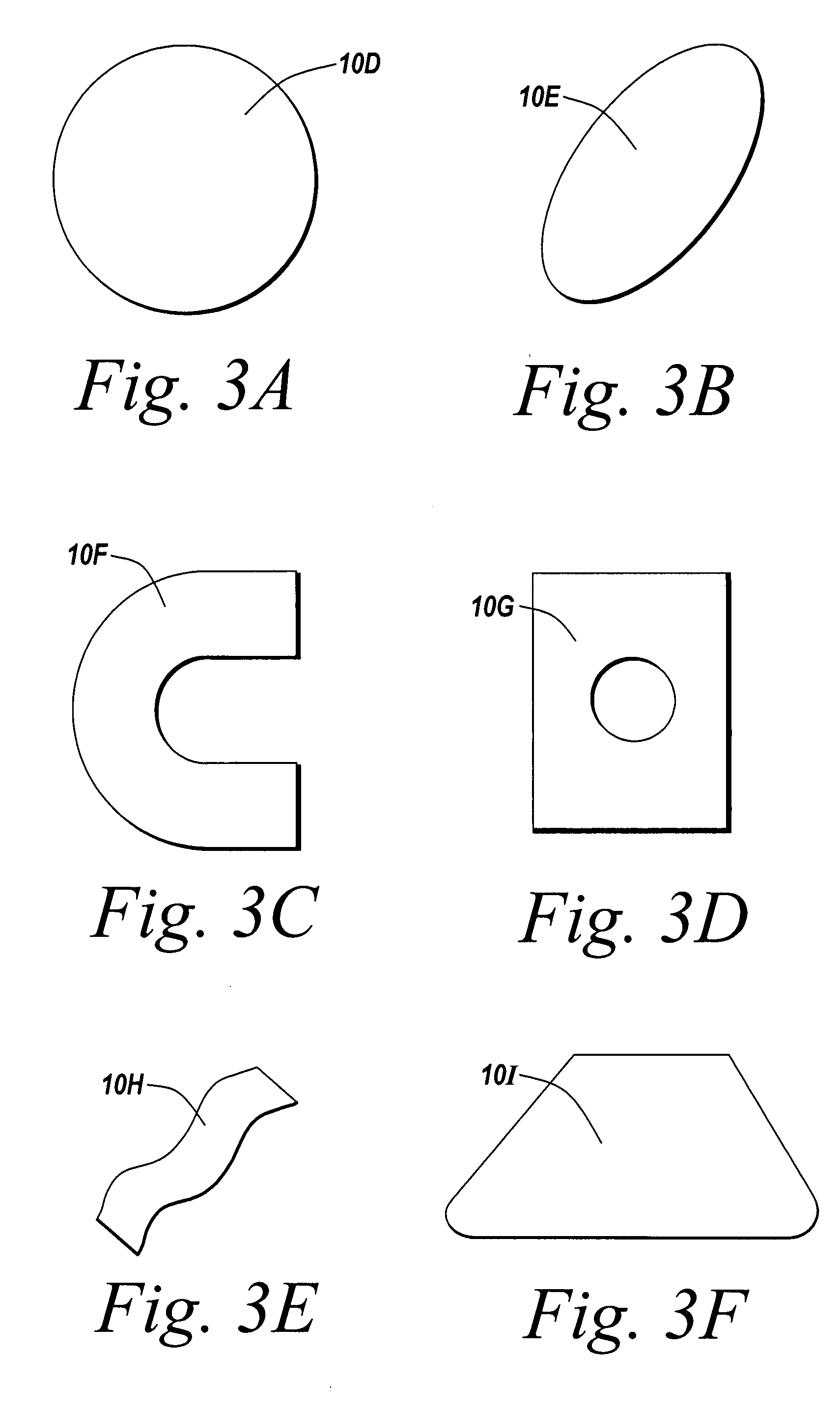 Tissue separating device with reinforced support for anchoring mechanisms