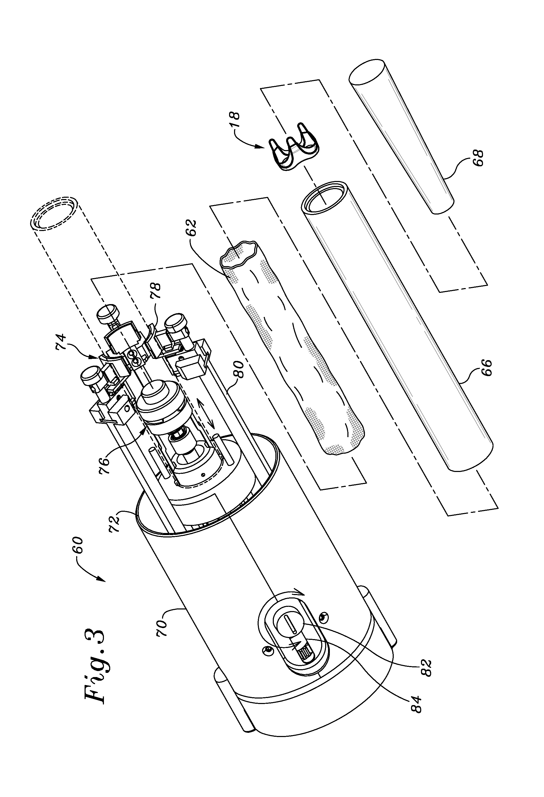Methods for assembling components of a fabric-covered prosthetic heart valve