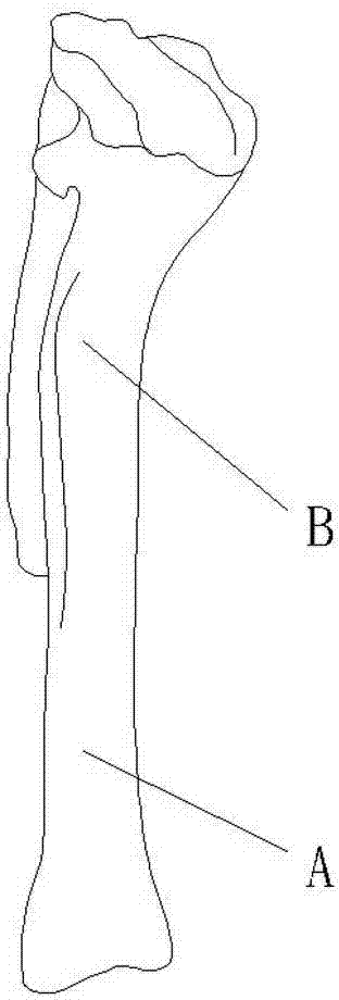 Combined osteotomy guide