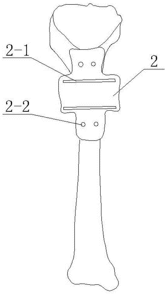 Combined osteotomy guide