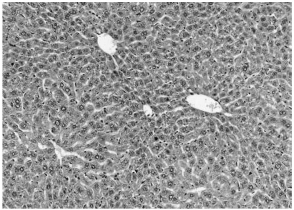 Application of Tinleaf vine and its extract in the preparation of medicines for treating and/or preventing alcoholic liver injury