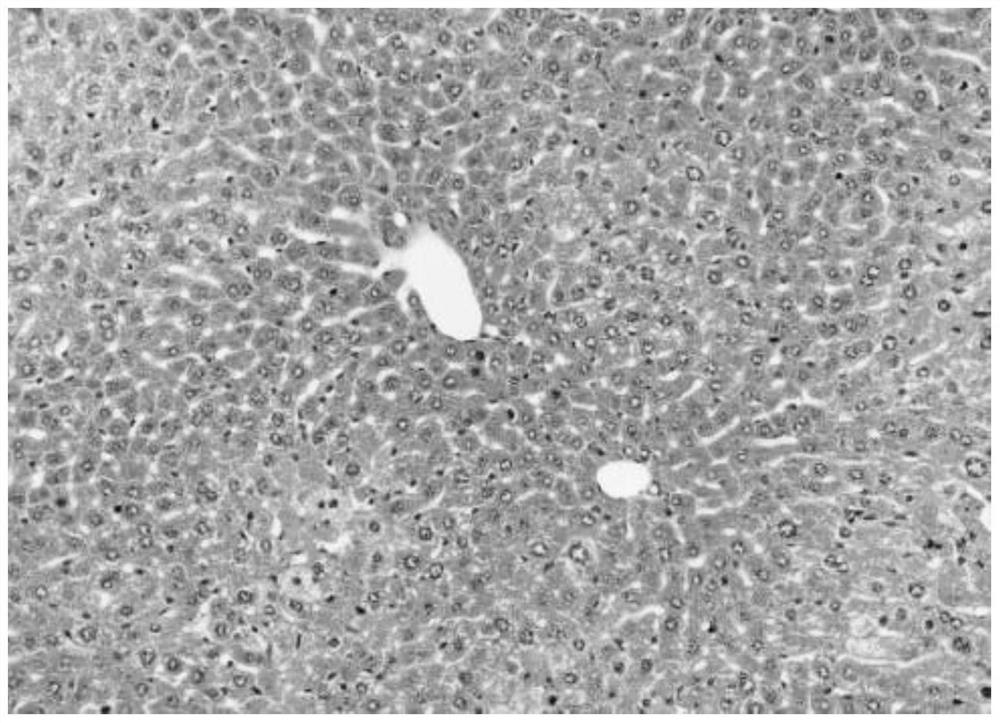 Application of Tinleaf vine and its extract in the preparation of medicines for treating and/or preventing alcoholic liver injury