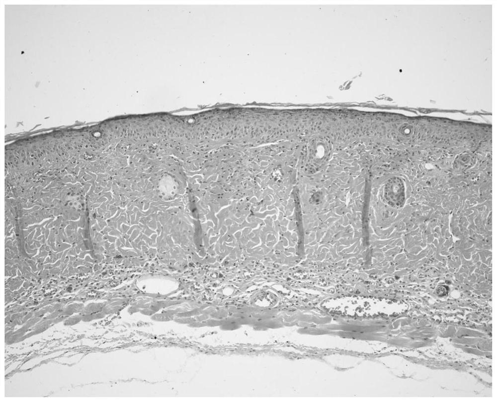 Anti-inflammatory composition, preparation method and application