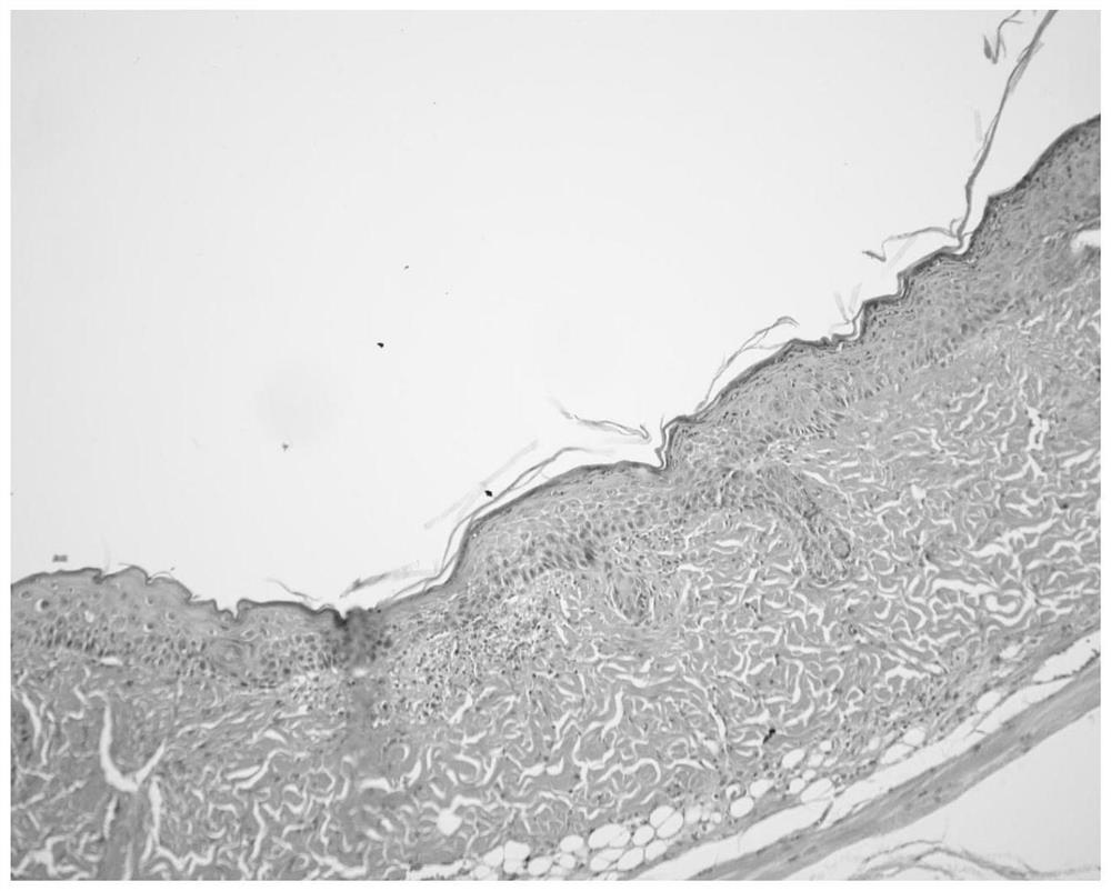 Anti-inflammatory composition, preparation method and application