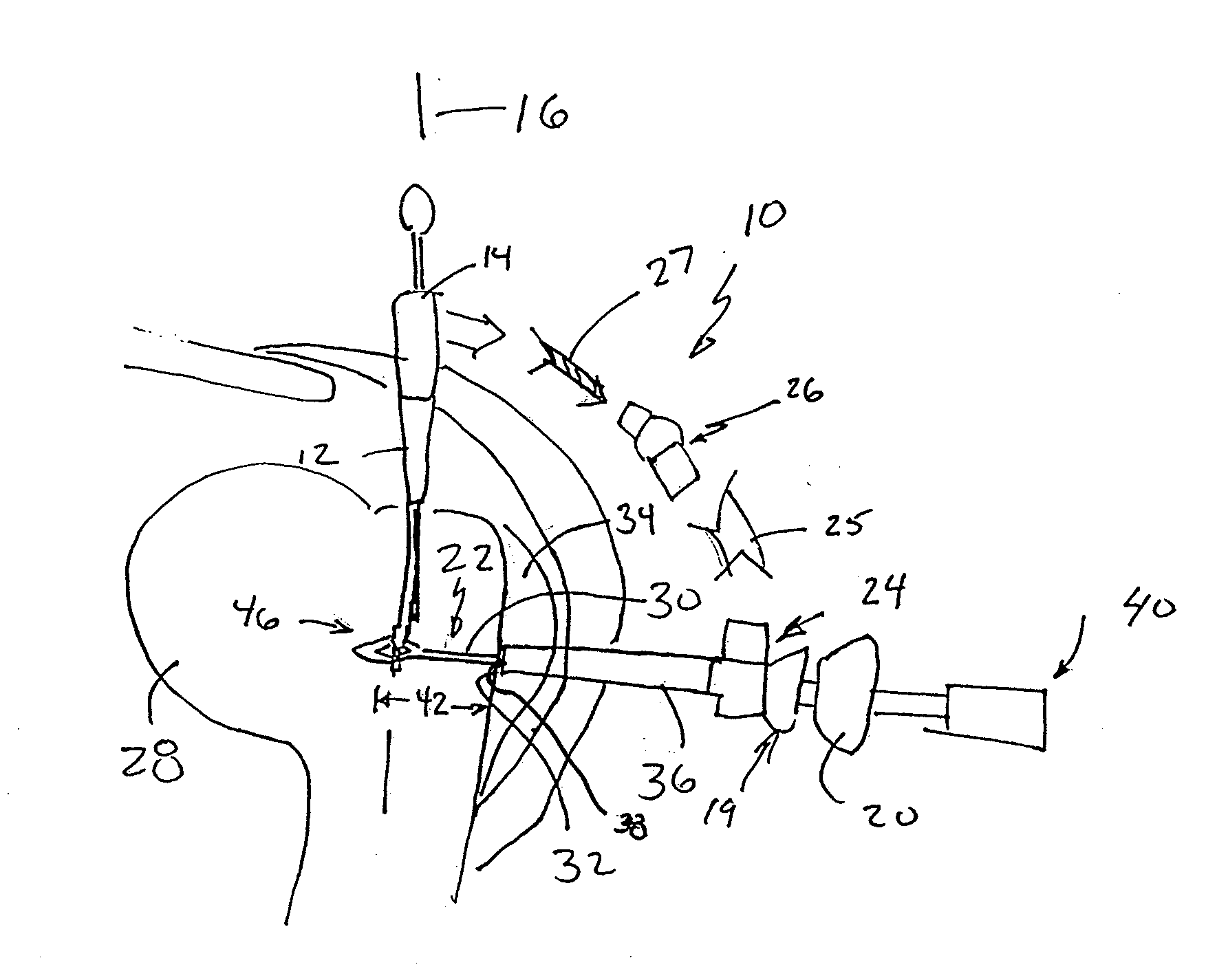 Surgical Drill Guide With Awl and Method of Use