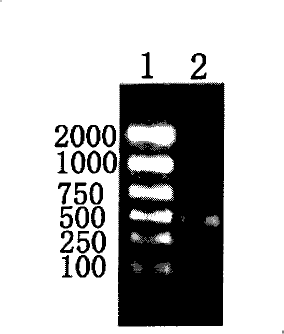 Paragonimiasis detection reagent kit and method for making same