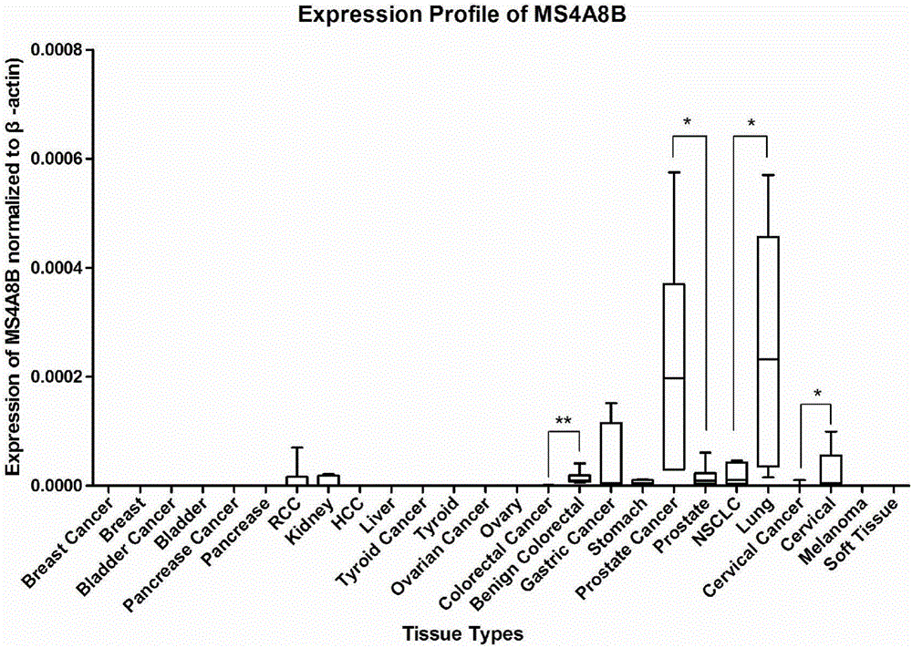 Method for studying on prostate cancer reoccurrence and metastasis