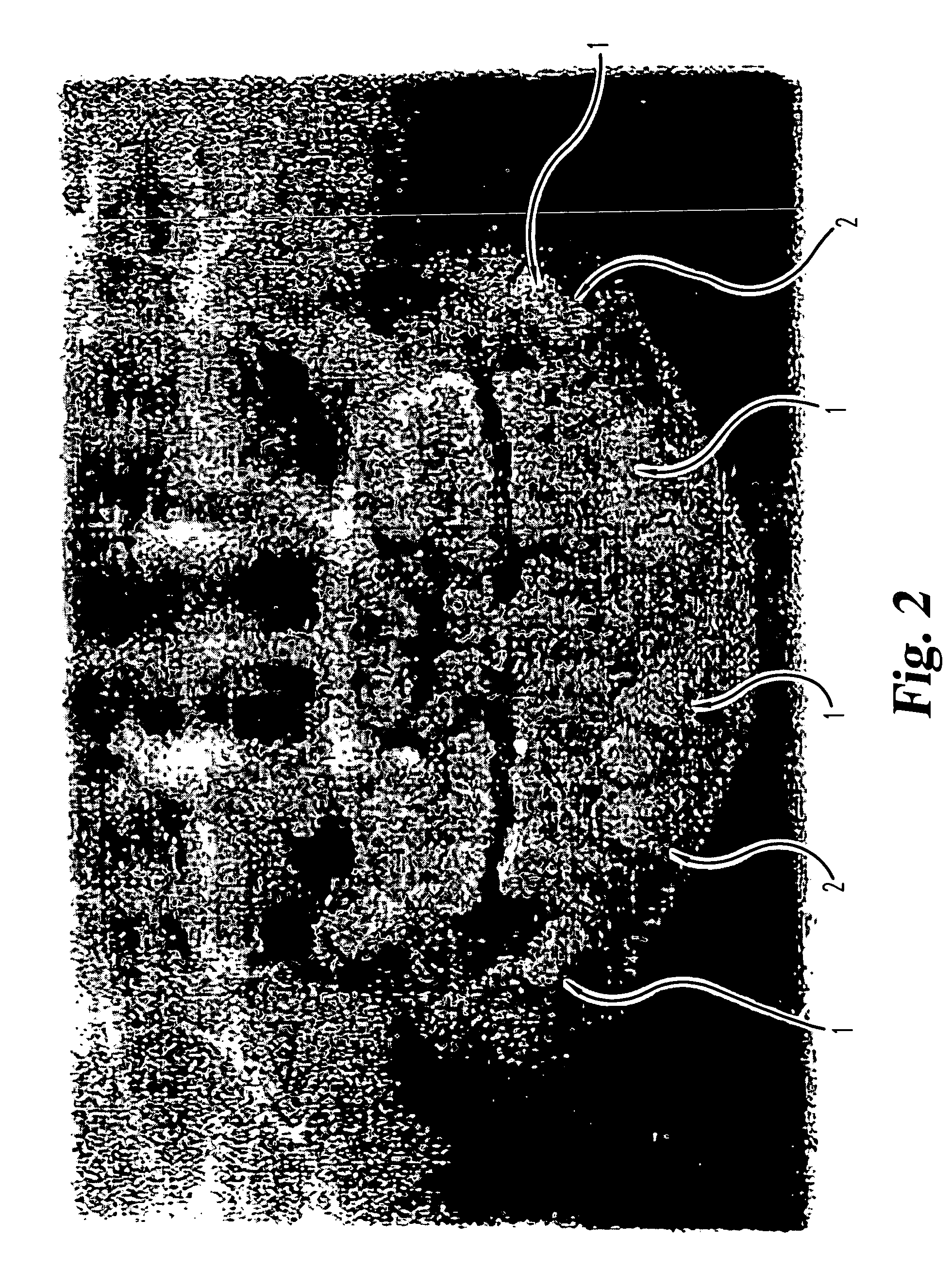 Method for obtaining and storing multipotent stem cells
