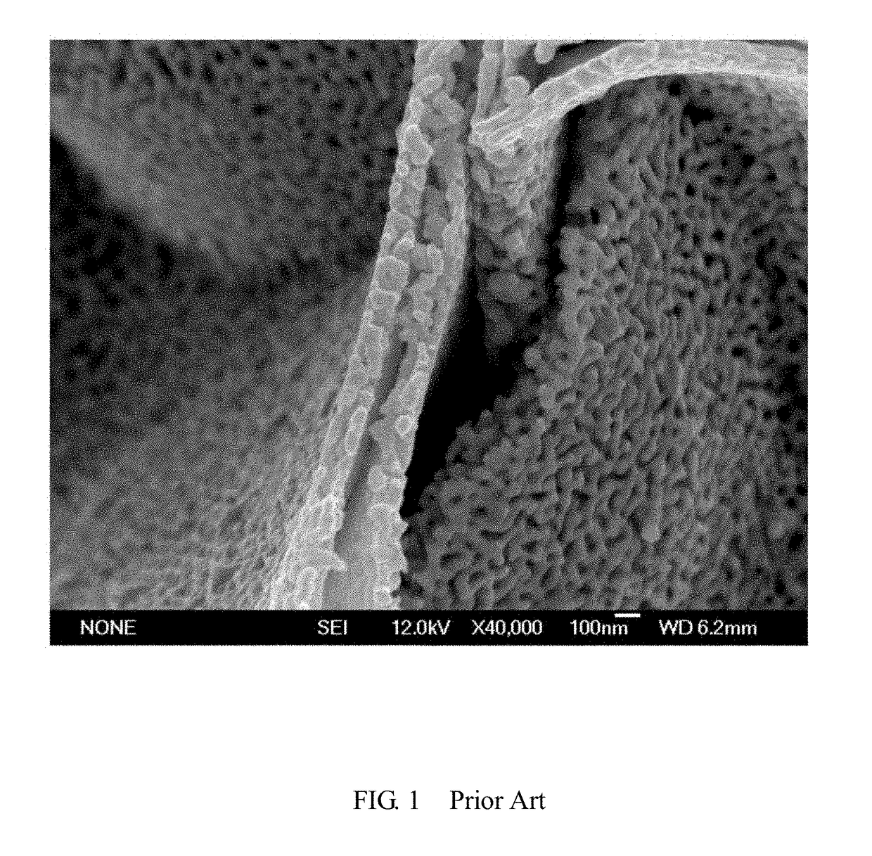 Composite structure with porous metal