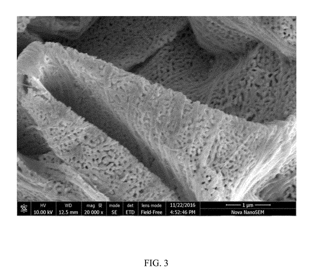 Composite structure with porous metal