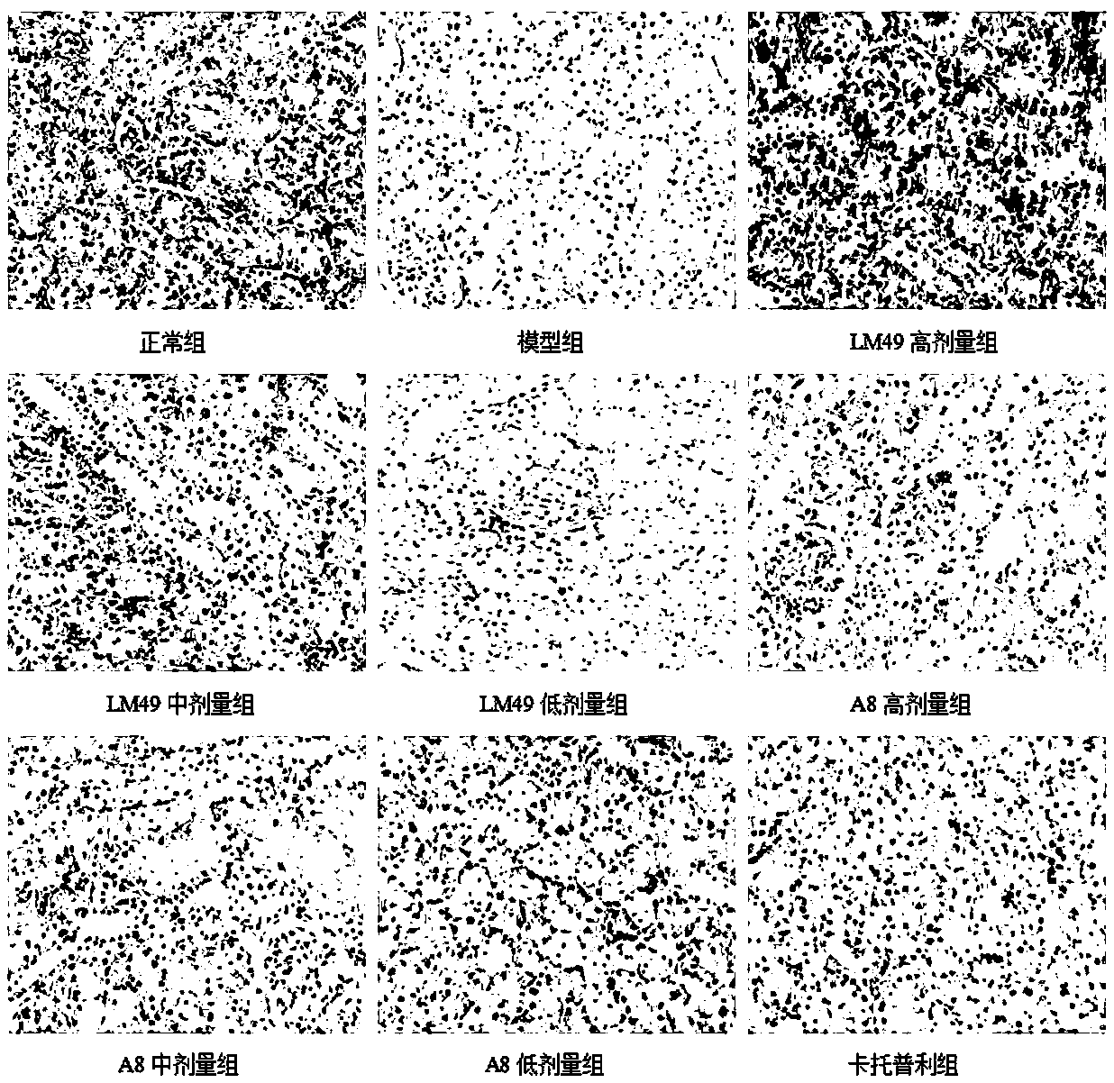 Application of Two Halophenol Compounds in the Preparation of Drugs Against Type Ⅱ Diabetic Nephropathy