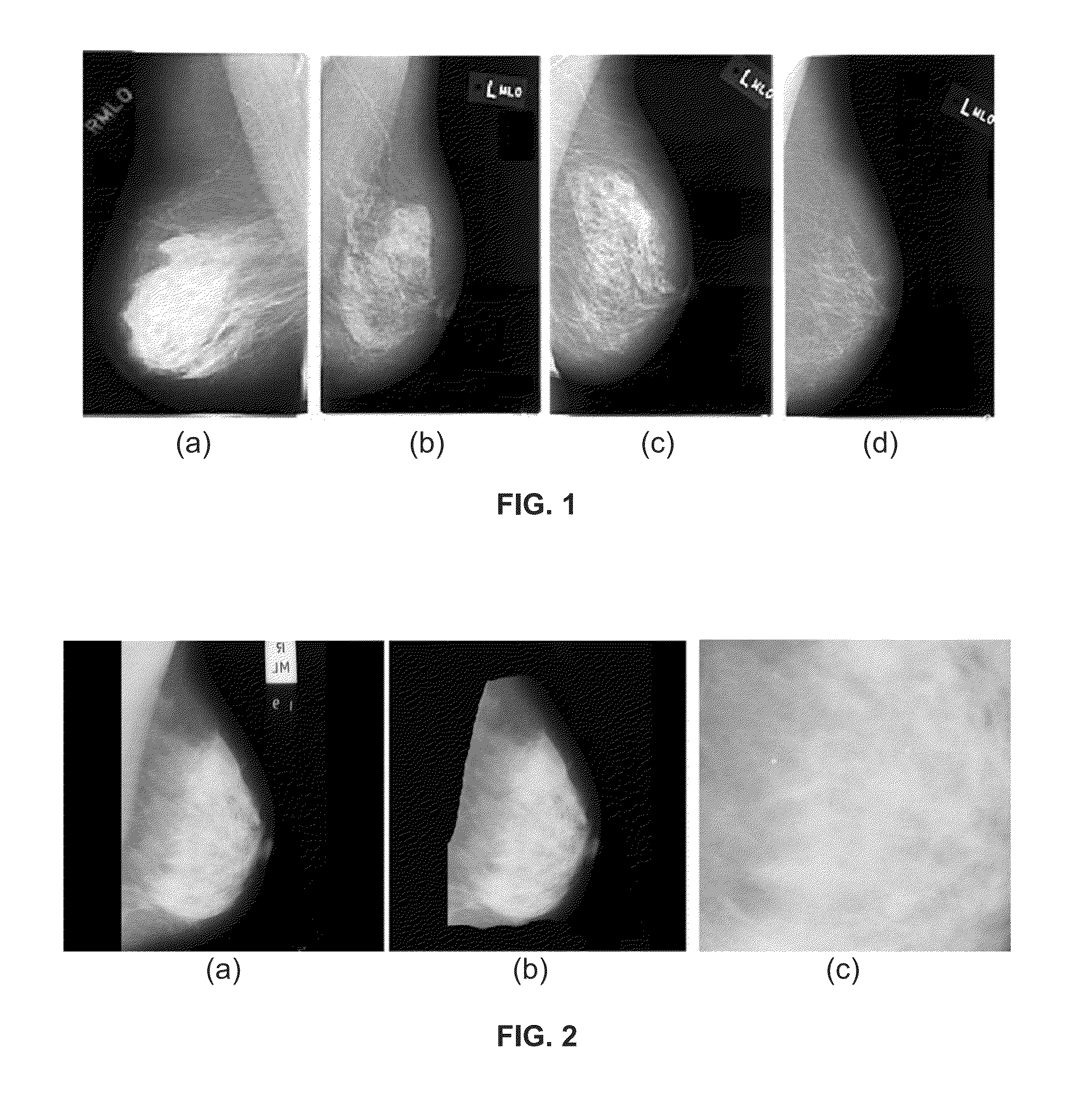 Method, system and computer program product for breast density classification using fisher discrimination