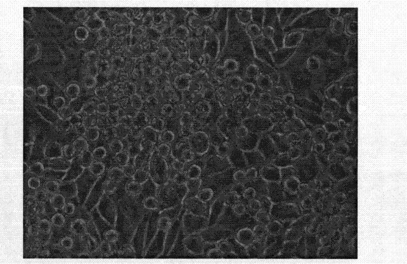 Parental human lung adenocarcinoma cell line with high potential of bone metastasis