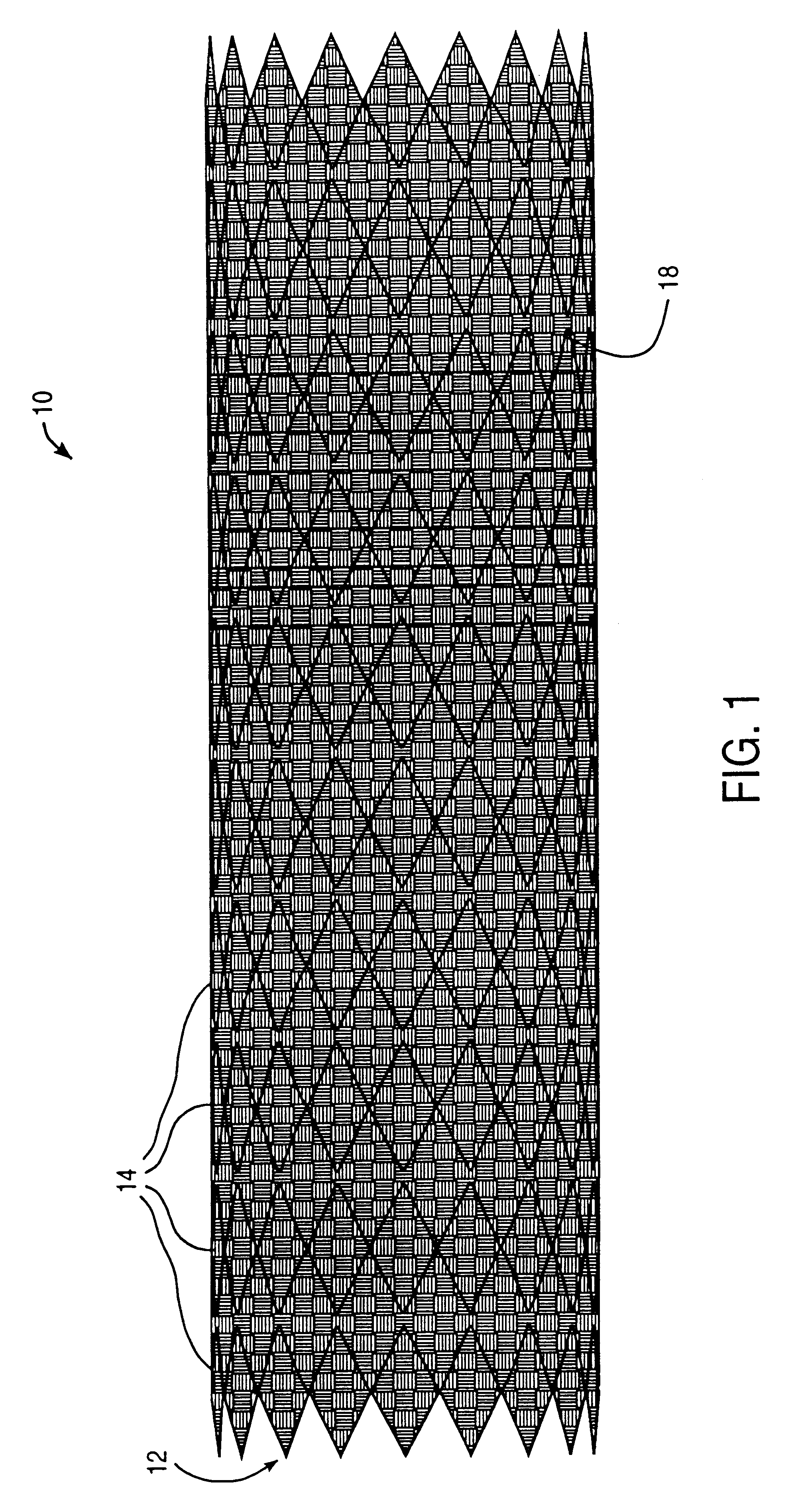 Modular intraluminal prosteheses construction and methods