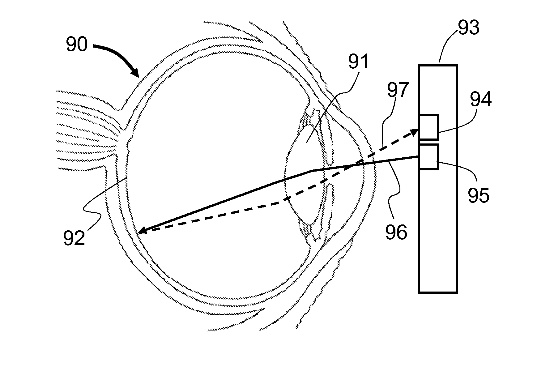 Method and apparatus to produce re-focusable vision with detecting re-focusing event from human eye