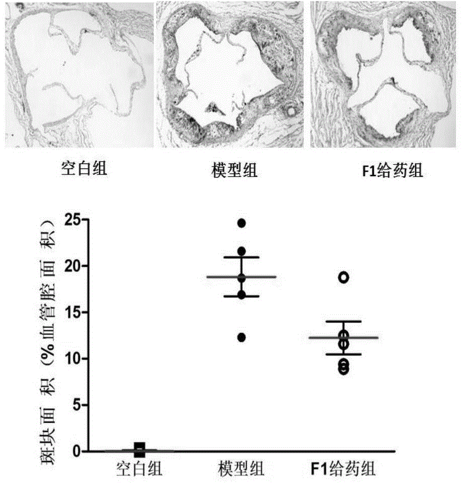 Application of ginsenoside F1 in preparation of anti-atherosclerosis medicament