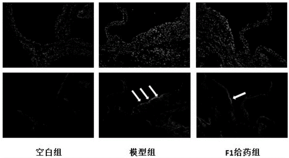 Application of ginsenoside F1 in preparation of anti-atherosclerosis medicament