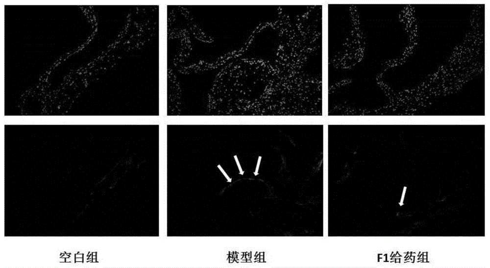 Application of ginsenoside F1 in preparation of anti-atherosclerosis medicament