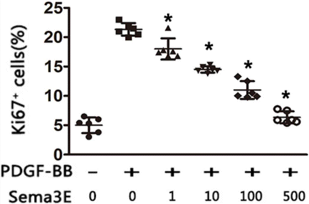 Use of Sema3E / PlexinD1 signaling pathway target drug in preparation of drug for inhibiting neointima formation