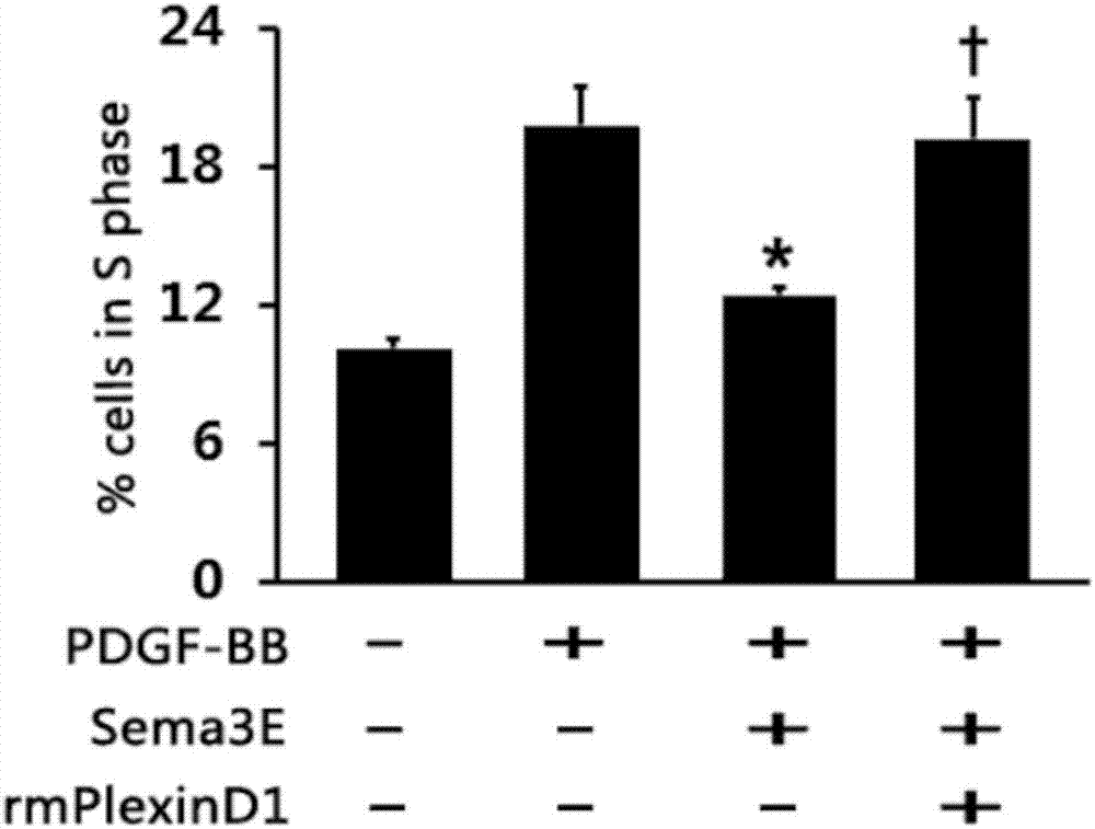 Use of Sema3E / PlexinD1 signaling pathway target drug in preparation of drug for inhibiting neointima formation