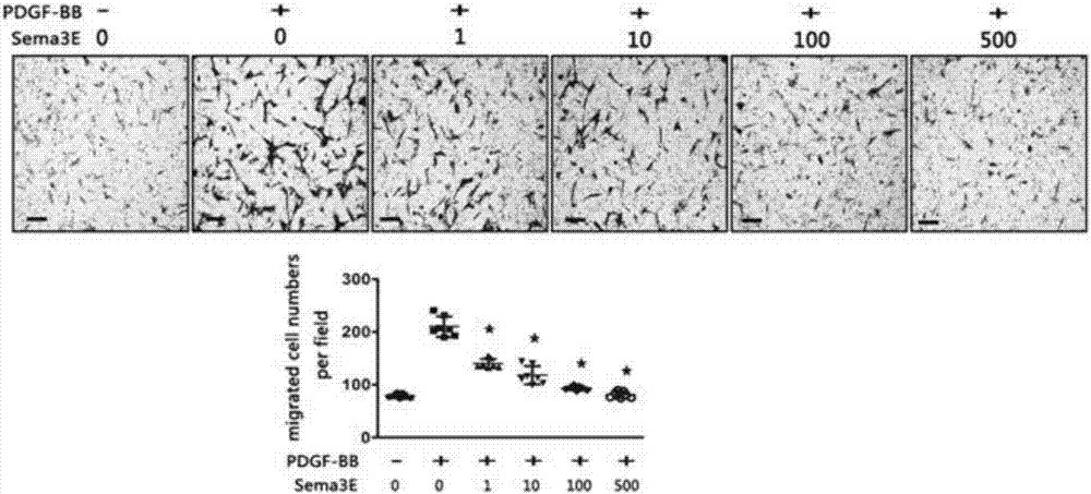 Use of Sema3E / PlexinD1 signaling pathway target drug in preparation of drug for inhibiting neointima formation