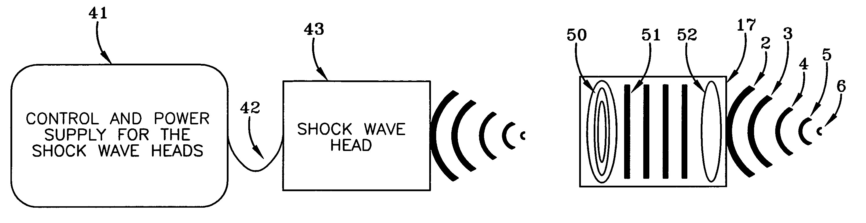Pressure pulse/shock wave therapy methods and an apparatus for conducting the therapeutic methods