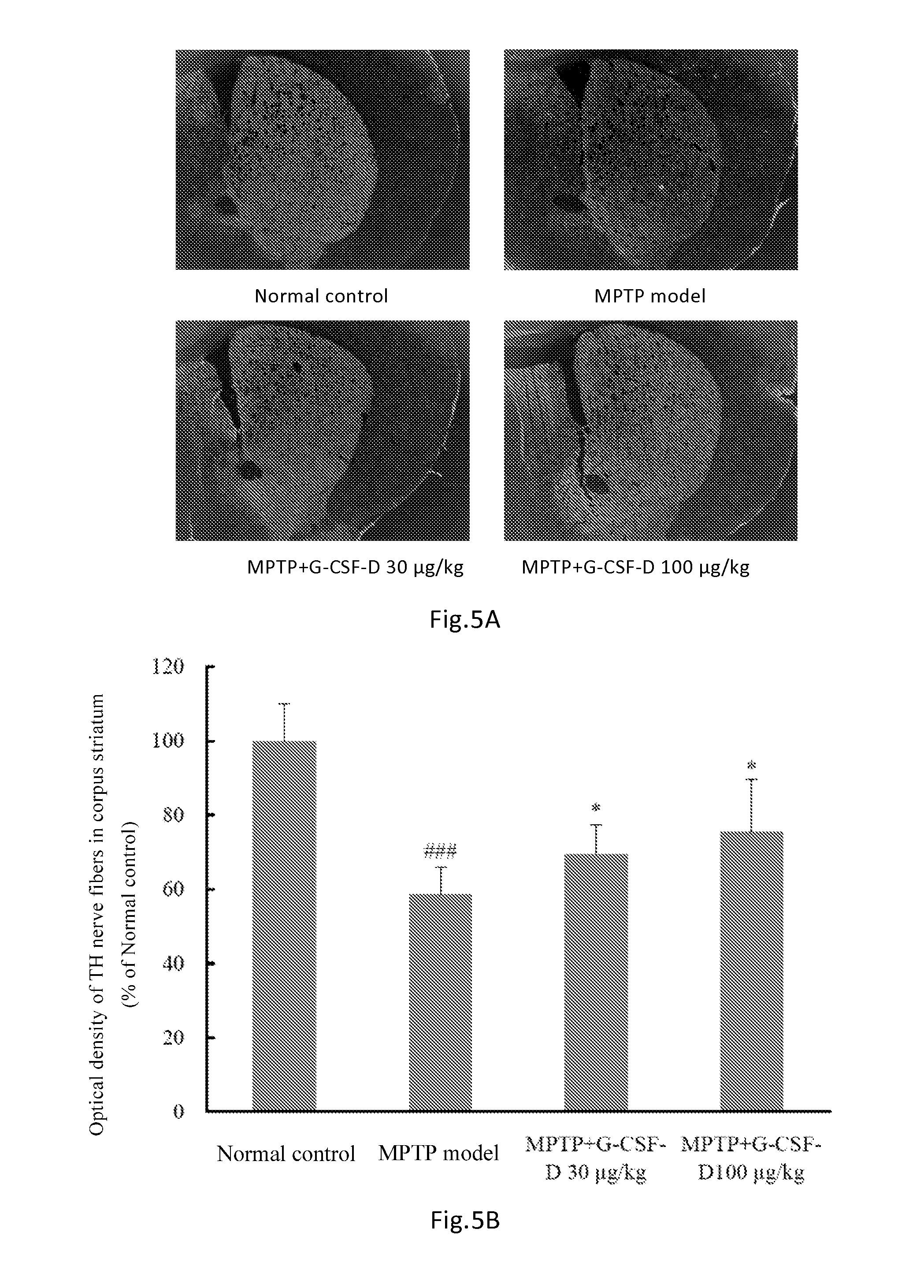 Use of g-csf dimer in preparation of medicament for treatment of neurodegenerative diseases