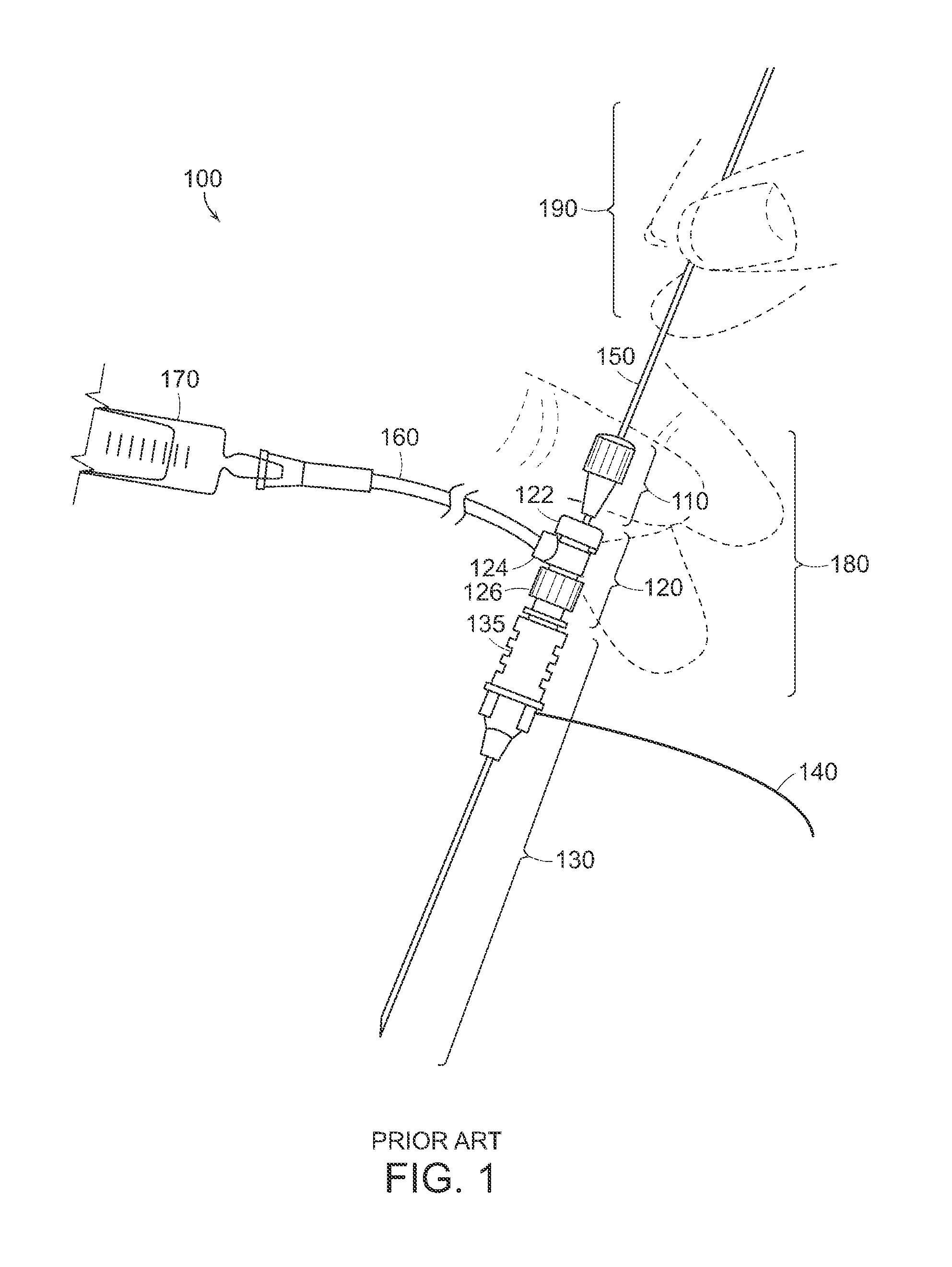 Catheter system and method for administering regional anesthesia to a patient
