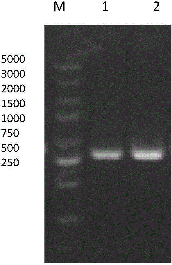 Thrombolytic enzyme gene, recombinant expression vector and recombinant bacteria comprising same and application
