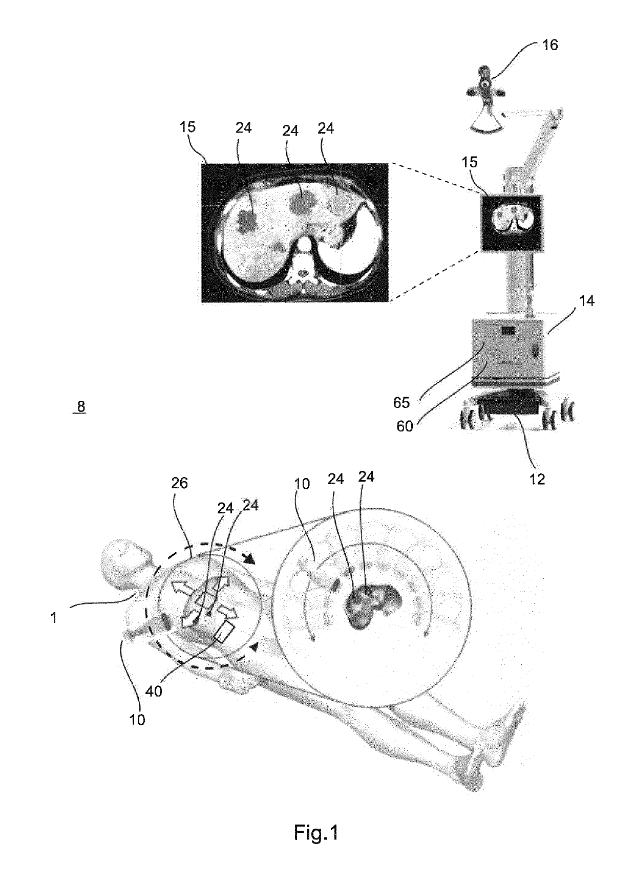 System and method for the determination of a dose in radiotherapy