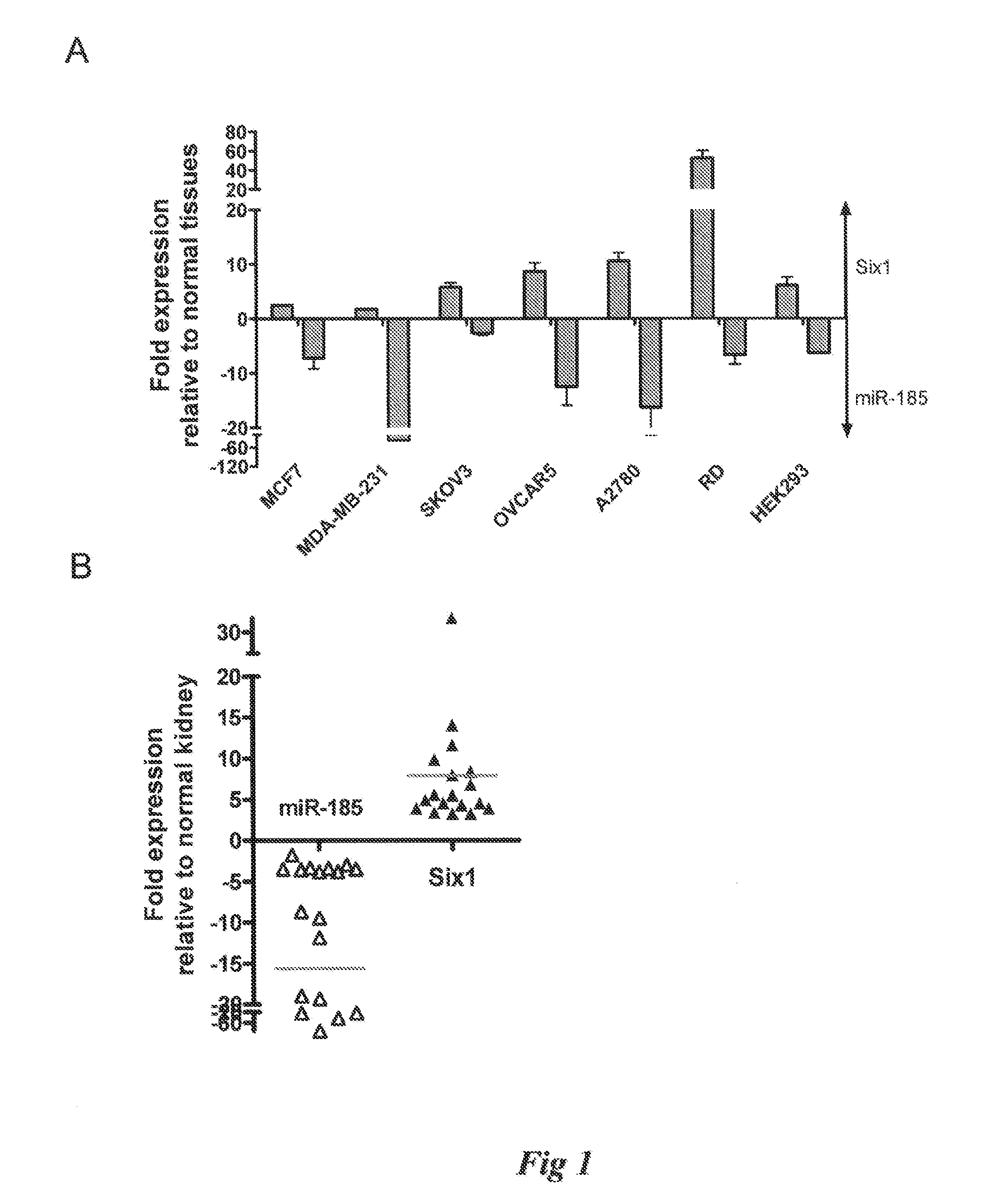 Methods and compositions for influencing tumors using microrna-185 as a tumor suppressor
