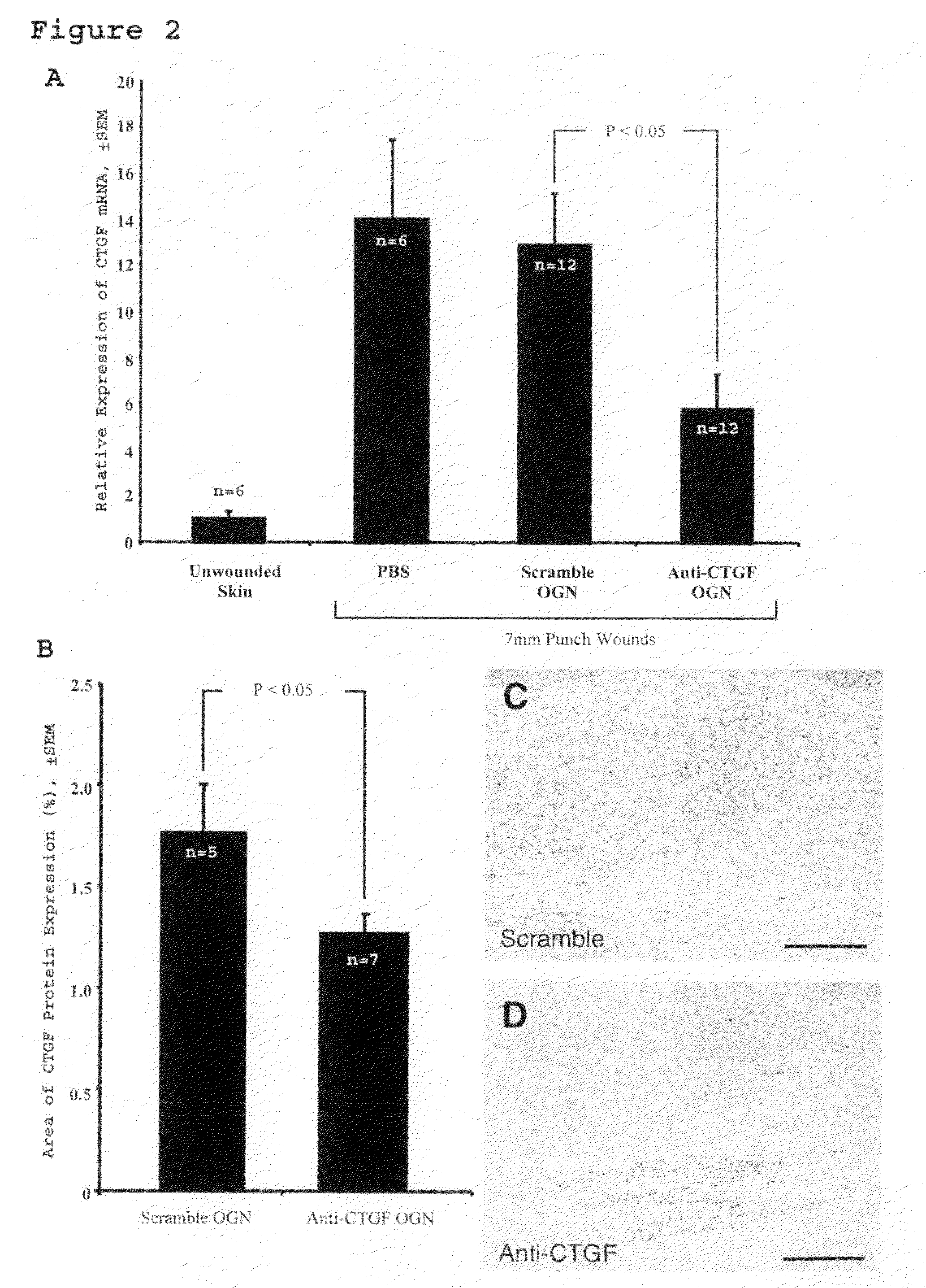 Method for reducing scarring during wound healing using antisense compounds directed to ctgf