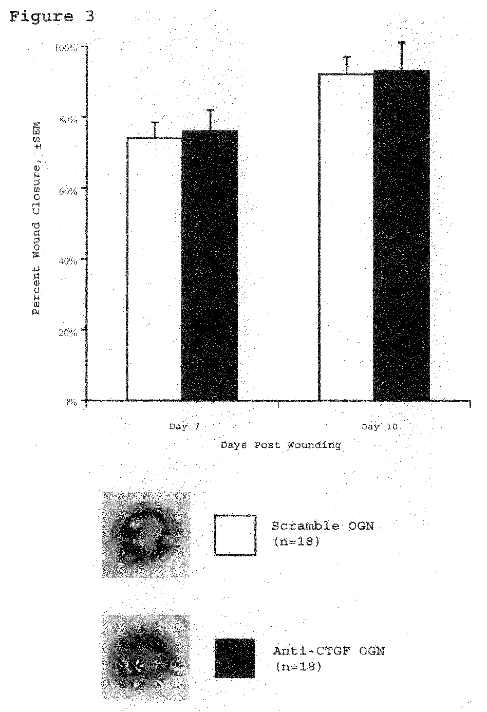 Method for reducing scarring during wound healing using antisense compounds directed to ctgf