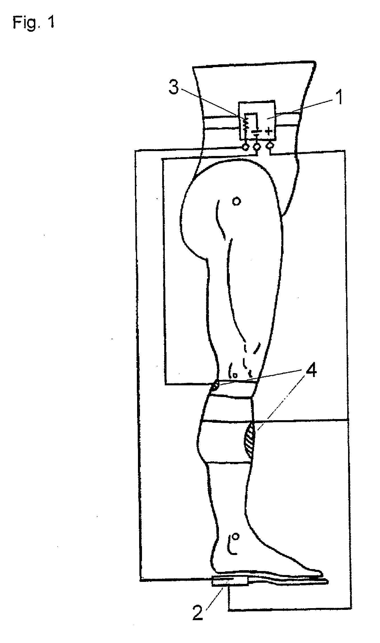 Methods and implantable systems for neural sensing and nerve stimulation