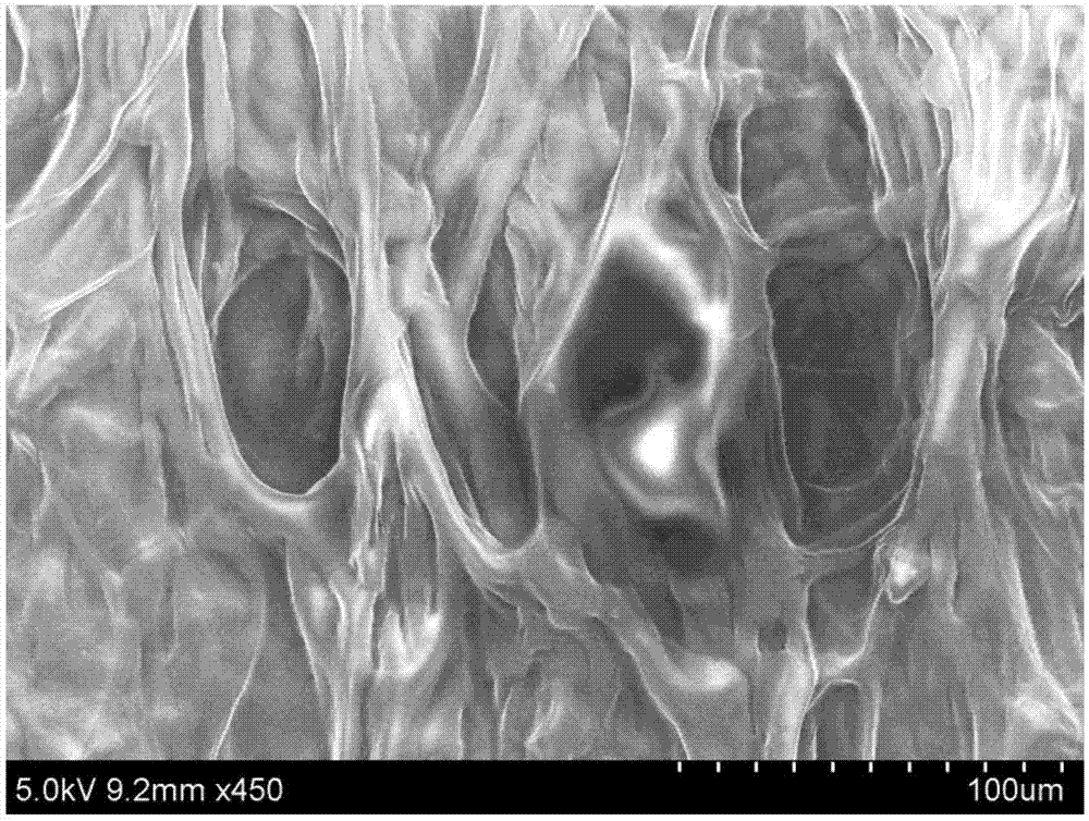 Chitosan-based periodontal local drug slow-release hydrogel and application thereof