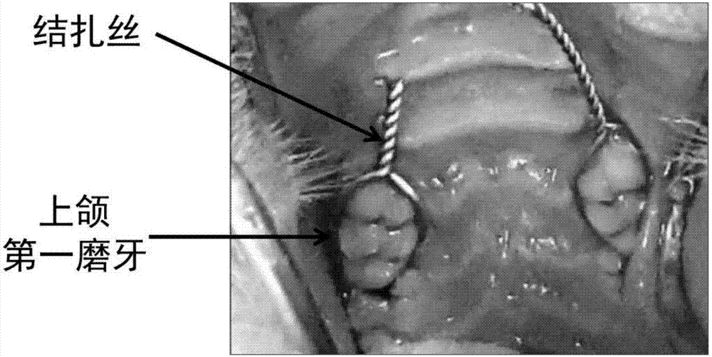 Chitosan-based periodontal local drug slow-release hydrogel and application thereof