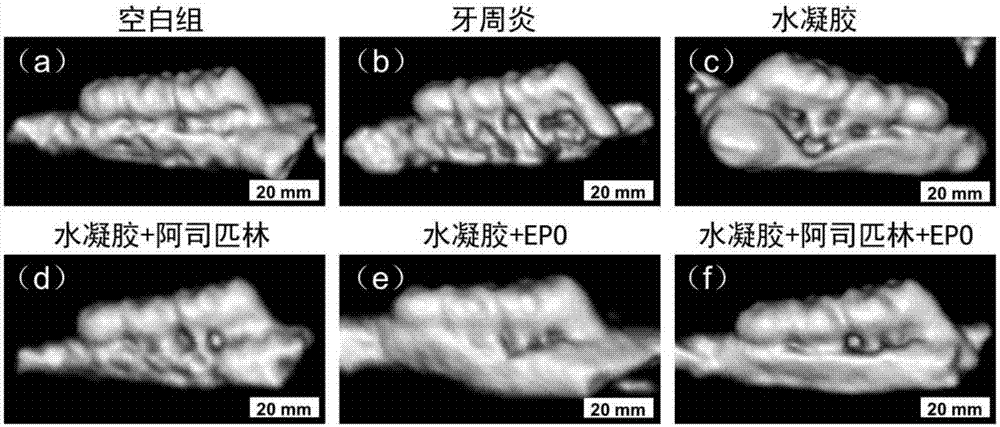 Chitosan-based periodontal local drug slow-release hydrogel and application thereof