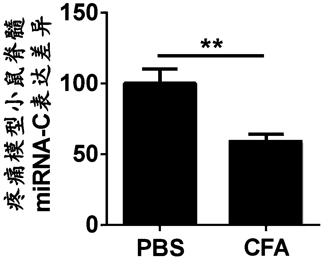 Application of miRNA-c compounds in the preparation of clinical diagnostic markers and therapeutic drugs for chronic pain diseases