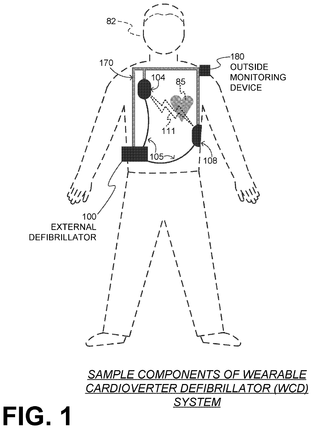 Medical device with enhanced electrocardiogram channel selection